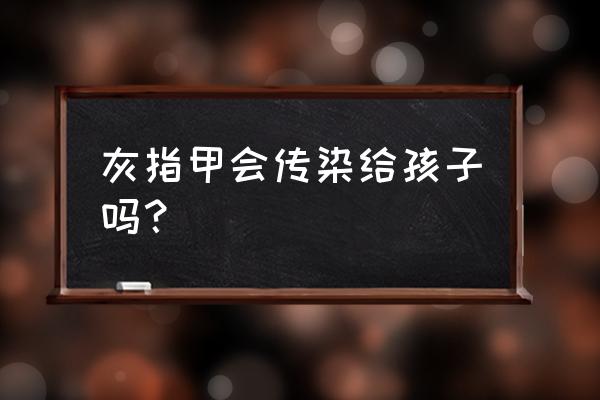 灰指甲人带孩子会传染吗 灰指甲会传染给孩子吗？