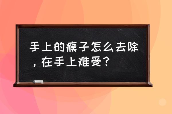 手上长瘊子民间说法 手上的瘊子怎么去除，在手上难受？