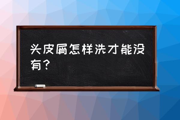 去头皮屑的简单方法 头皮屑怎样洗才能没有？