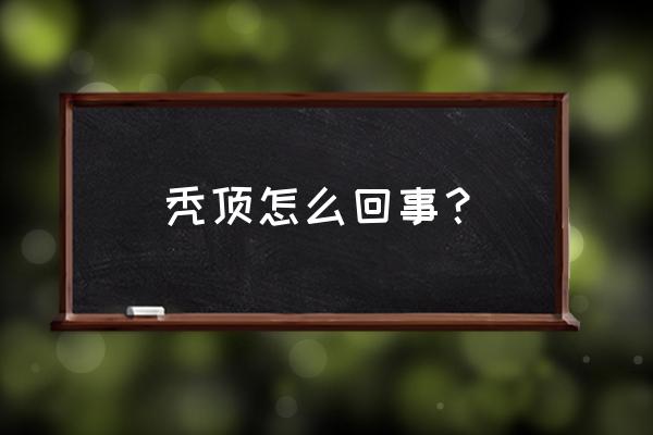 男人秃顶的主要原因 秃顶怎么回事？