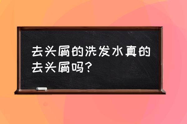 去头屑的洗发水有用吗 去头屑的洗发水真的去头屑吗？