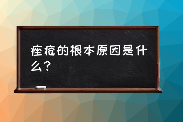 哪些人容易得痤疮 痤疮的根本原因是什么？