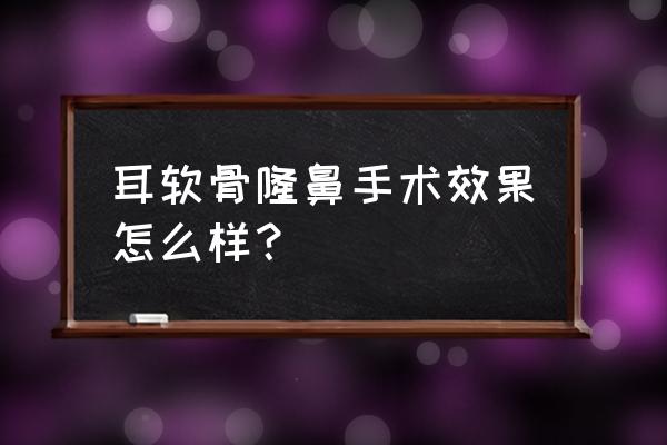 鼻中隔耳软骨隆鼻 耳软骨隆鼻手术效果怎么样？