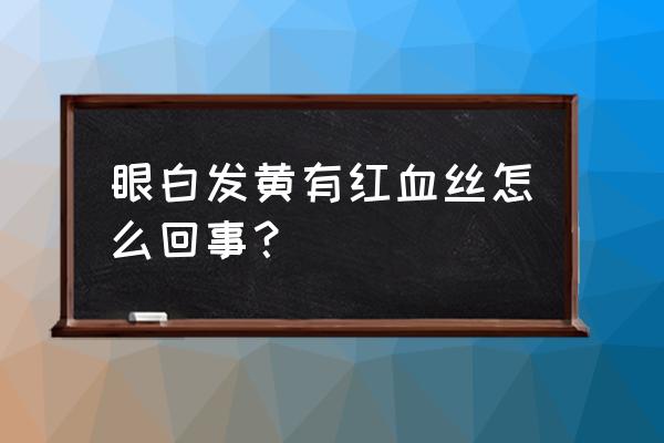 眼白浑浊发黄有血丝 眼白发黄有红血丝怎么回事？