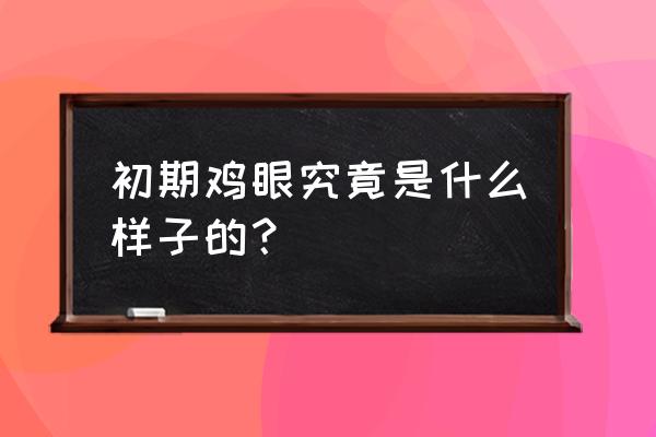 轻微的鸡眼是什么样子 初期鸡眼究竟是什么样子的？