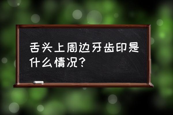 舌头一圈有齿痕是什么原因 舌头上周边牙齿印是什么情况？