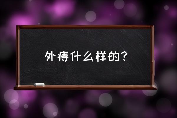 怎么分辨外痔的种类 外痔什么样的？