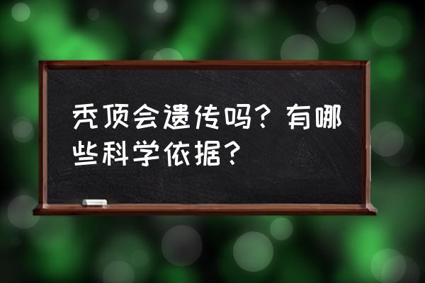 秃头遗传规律 秃顶会遗传吗？有哪些科学依据？