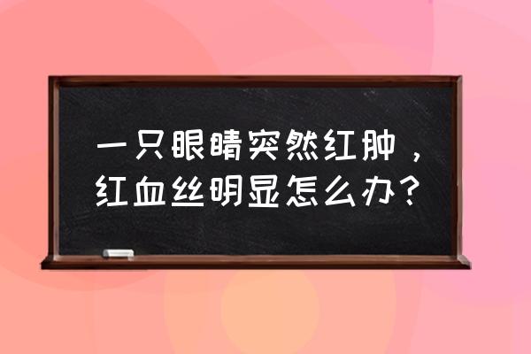 一只眼睛里有红血丝 一只眼睛突然红肿，红血丝明显怎么办？