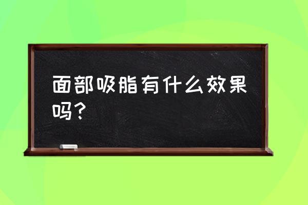 吸脂修复可以修复哪些问题 面部吸脂有什么效果吗？