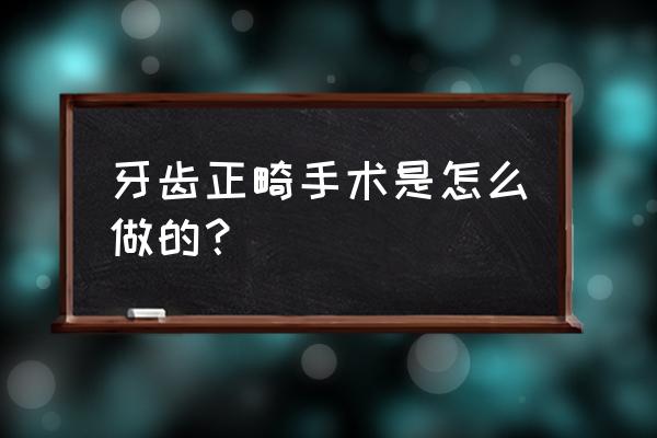 牙齿矫正过程 牙齿正畸手术是怎么做的？