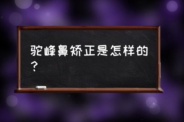 驼峰鼻自己可以纠正吗 驼峰鼻矫正是怎样的？