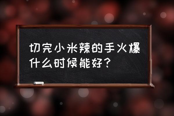 切辣椒手辣一般辣多久 切完小米辣的手火爆什么时候能好？