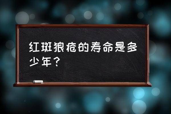 红斑狼疮一般可以活多久 红斑狼疮的寿命是多少年？