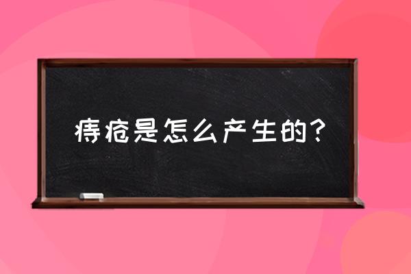 痔疮一般是怎么引起的 痔疮是怎么产生的？