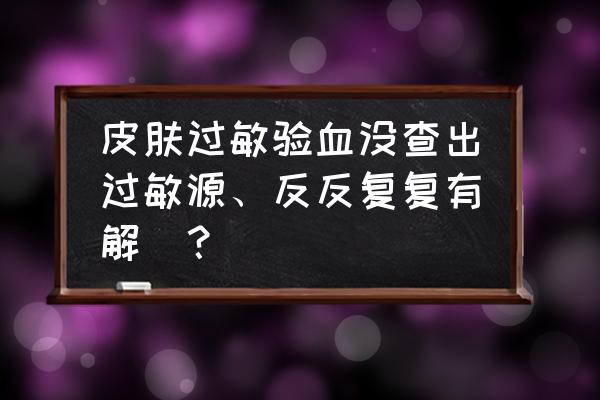 全身皮肤过敏怎么处理 皮肤过敏验血没查出过敏源、反反复复有解嚒？