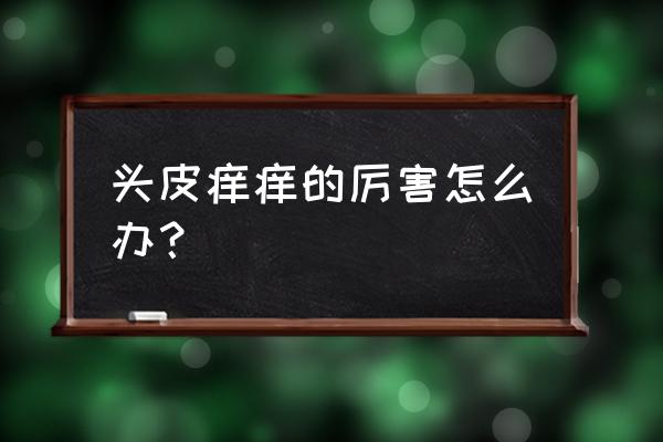 头皮痒怎么回事 头皮痒痒的厉害怎么办？