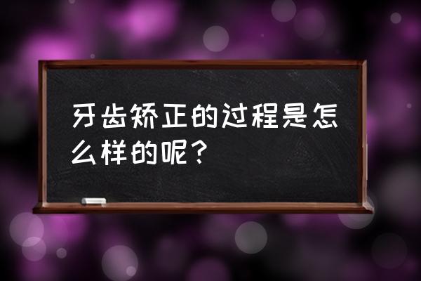 怎么牙齿矫正 牙齿矫正的过程是怎么样的呢？