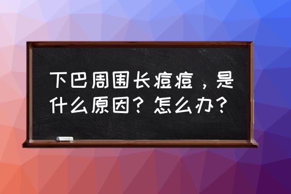 下巴老是起痘痘 下巴周围长痘痘，是什么原因？怎么办？