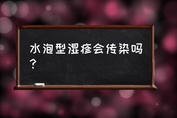 正常的皮肤接触湿疹部位会传染吗 水泡型湿疹会传染吗？