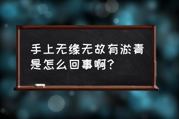 身上平白无故有淤青什么原因 手上无缘无故有淤青是怎么回事啊？